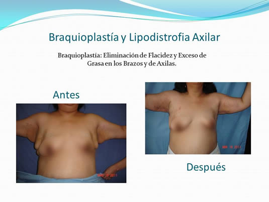 Slide10