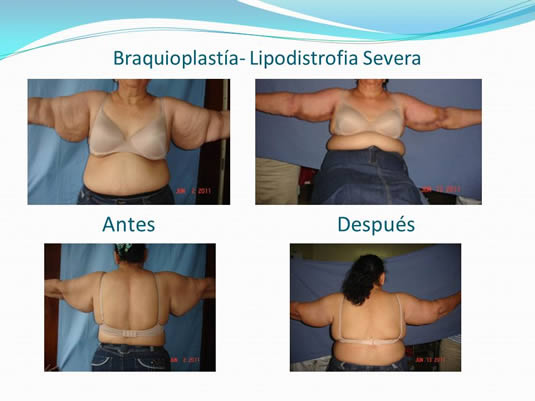 Slide11