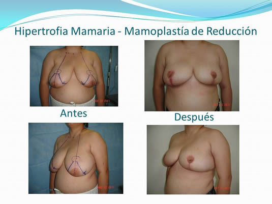 Slide13