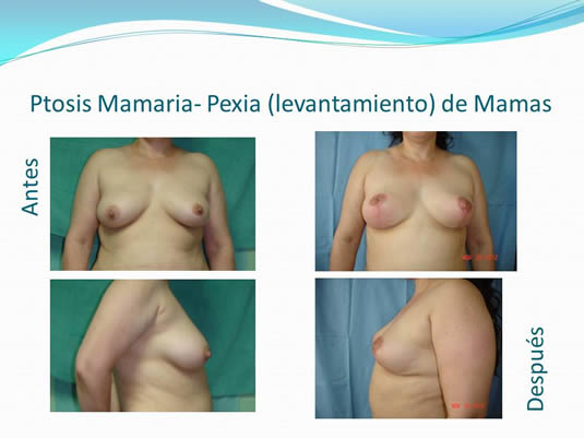 Slide14