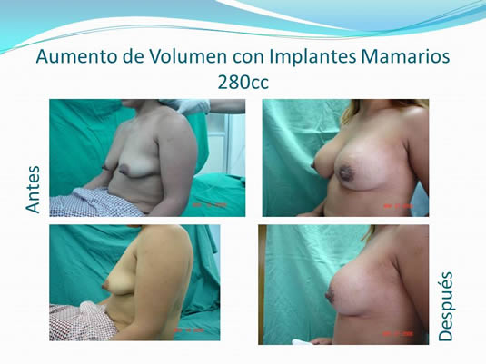 Slide15