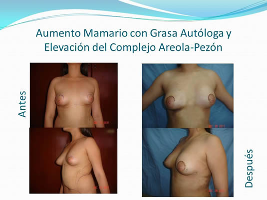 Slide17