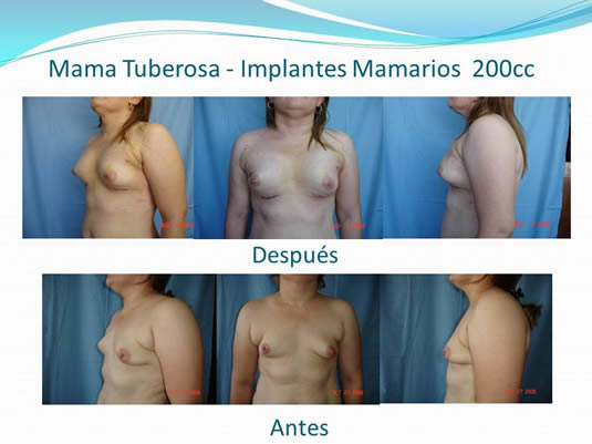 Slide18