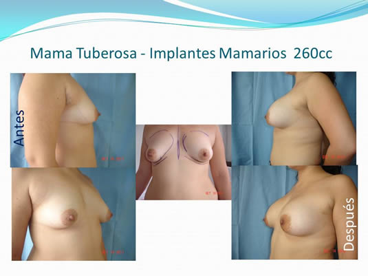 Slide19