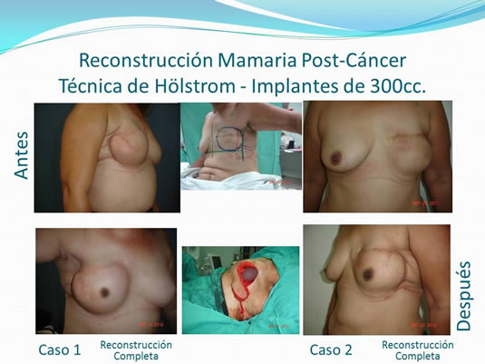 Slide20