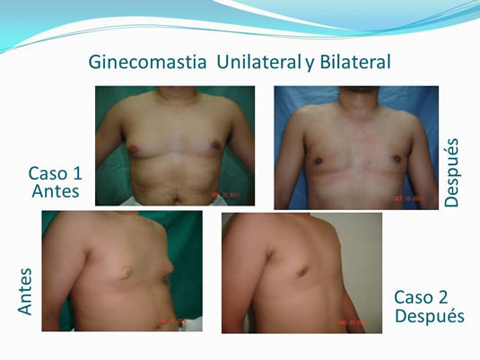 Slide21