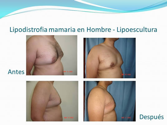 Slide22