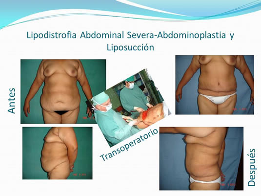 Slide24