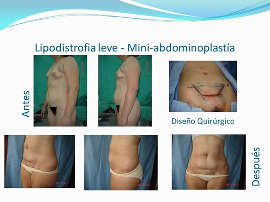 Slide25