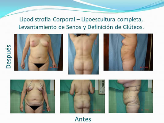 Slide26