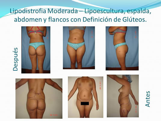 Slide27