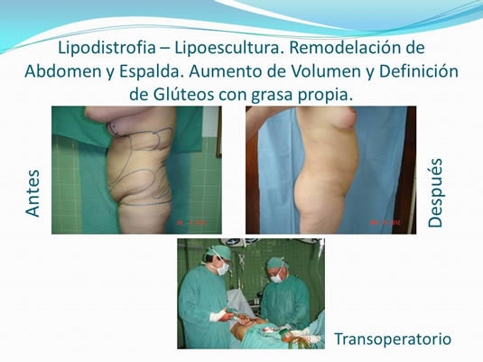 Slide28
