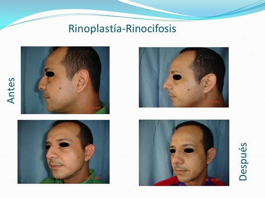 Slide3