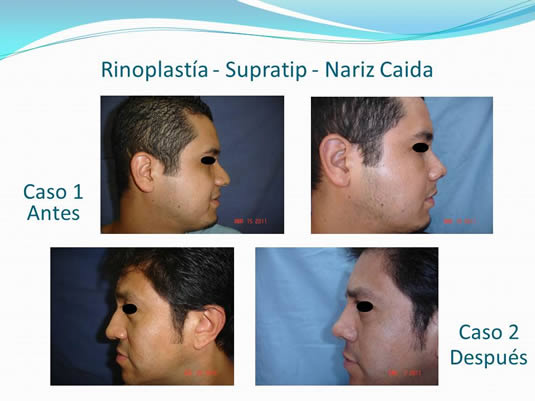 Slide5