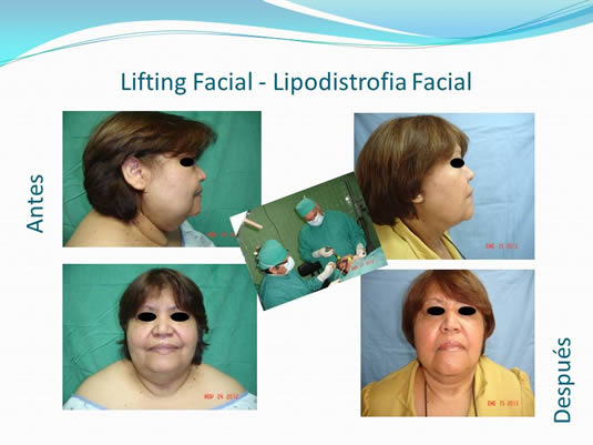 Slide8