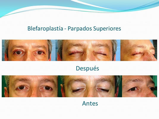 Slide9