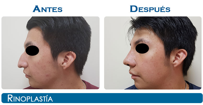 ncaso21-2