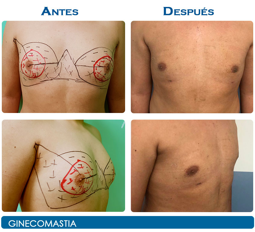 ncaso21-8