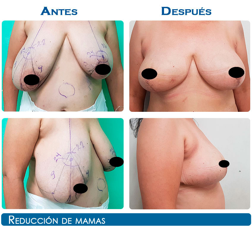reduccion-1-22